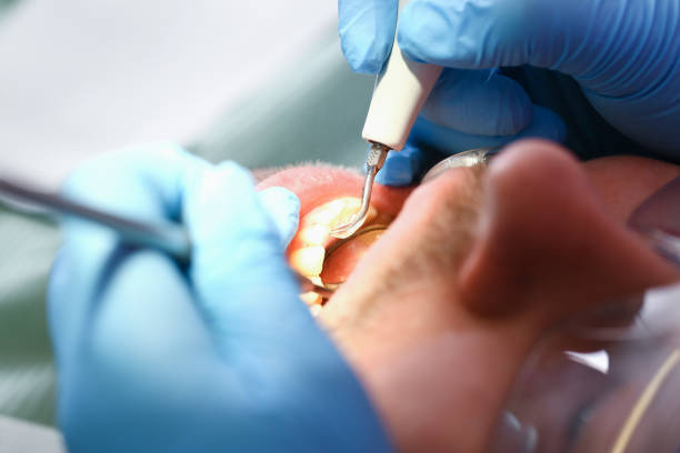 Best Weekend Emergency Dentist in Hainesvle, IL