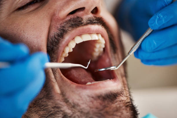 Best Emergency Treatment for Dental Infections or Abscesses in Hainesvle, IL