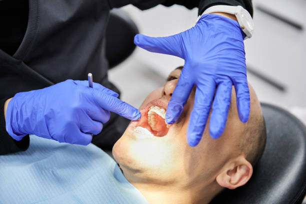 Best After-Hours Dental Trauma Care in Hainesvle, IL